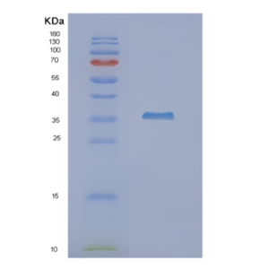 Recombinant Human NUDT9 Protein