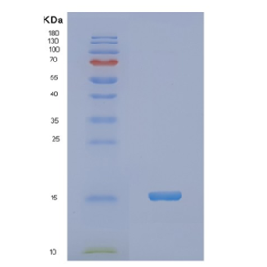 Recombinant Human NDUFA5 Protein
