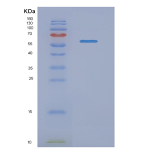 Recombinant Human NMT1 Protein,Recombinant Human NMT1 Protein