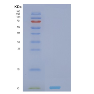 Recombinant Human NRGN Protein,Recombinant Human NRGN Protein