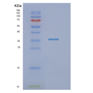 Recombinant Human NTHL1 Protein,Recombinant Human NTHL1 Protein