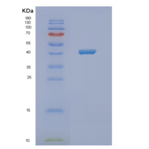 Recombinant Human NFKBIB Protein,Recombinant Human NFKBIB Protein