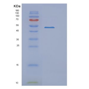 Recombinant Human NOB1 Protein