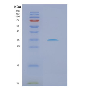 Recombinant Human NQO2 Protein,Recombinant Human NQO2 Protein
