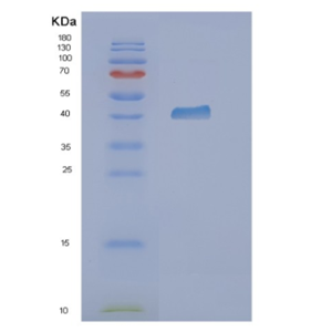 Recombinant Human OAS1 Protein,Recombinant Human OAS1 Protein