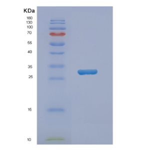 Recombinant Human NKX3-1 Protein,Recombinant Human NKX3-1 Protein