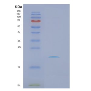 Recombinant Human NRAS Protein