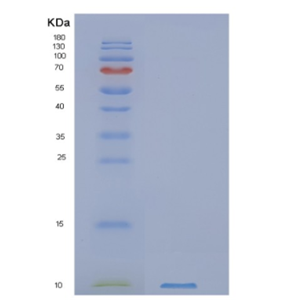 Recombinant Human NUP62CL Protein