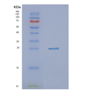 Recombinant Human NXT2 Protein,Recombinant Human NXT2 Protein