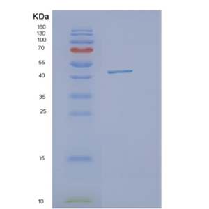 Recombinant Human OBFC1 Protein