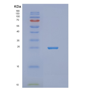 Recombinant Human NUDT16L1 Protein