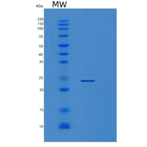 Recombinant Human ORM2 Protein,Recombinant Human ORM2 Protein