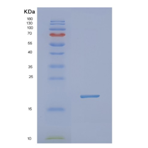 Recombinant Human NXT1 Protein