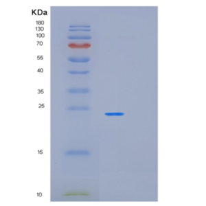 Recombinant Human OLR1 Protein
