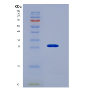 Recombinant Osteoprotegerin (OPG)