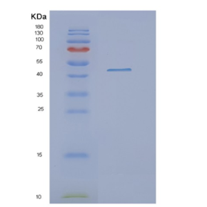 Recombinant Human OAT Protein