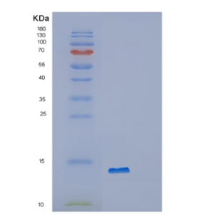 Recombinant Human OXLD1 Protein,Recombinant Human OXLD1 Protein