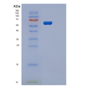 Recombinant Human OXSR1 Protein