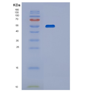 Recombinant Human P4HB Protein,Recombinant Human P4HB Protein