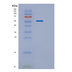 Recombinant Mouse P4HB Protein,Recombinant Mouse P4HB Protein