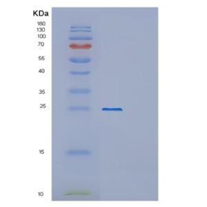 Recombinant Human OVCA2 Protein,Recombinant Human OVCA2 Protein