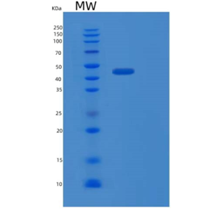 Recombinant Human PEDF Protein,Recombinant Human PEDF Protein