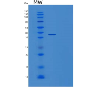 Recombinant Human PDXK Protein,Recombinant Human PDXK Protein