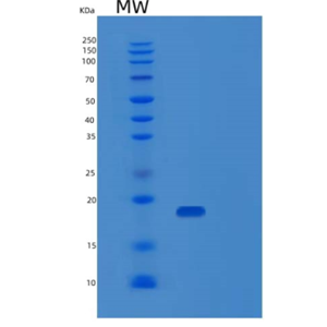 Recombinant Human PDZD11 Protein