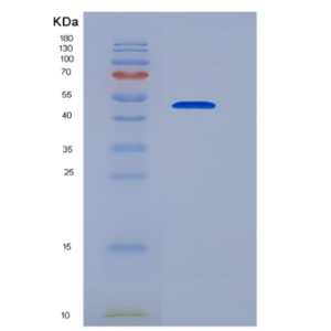 Recombinant Platelet Derived Growth Factor D (PDGFD)
