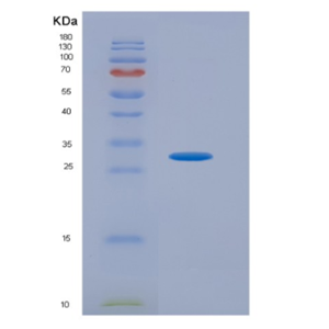 Recombinant Platelet Derived Growth Factor Receptor Alpha (PDGFRa),Recombinant Platelet Derived Growth Factor Receptor Alpha (PDGFRa)