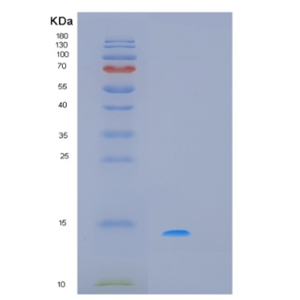 Recombinant Human PDCD5 Protein,Recombinant Human PDCD5 Protein