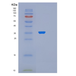 Recombinant Human PDCL Protein,Recombinant Human PDCL Protein