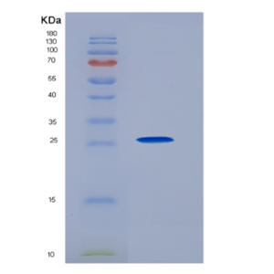 Recombinant Programmed Cell Death Protein 1 Ligand 2 (PDL2)