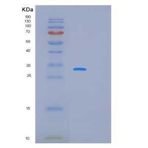 Recombinant Human PCNA Protein,Recombinant Human PCNA Protein