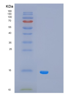 Recombinant Human PCBD1 Protein,Recombinant Human PCBD1 Protein