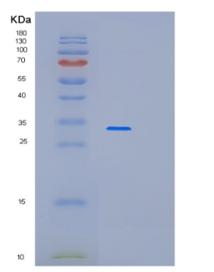 Recombinant Human PARVA Protein,Recombinant Human PARVA Protein