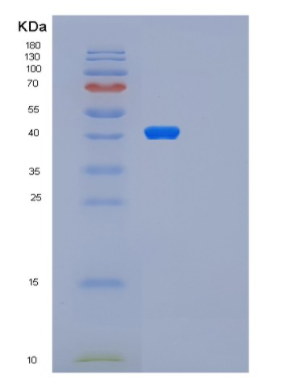 Recombinant Human PARP2 Protein,Recombinant Human PARP2 Protein