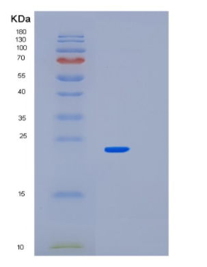 Recombinant Mouse Park7 Protein,Recombinant Mouse Park7 Protein