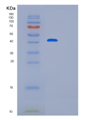 Recombinant Human PARD6B Protein,Recombinant Human PARD6B Protein