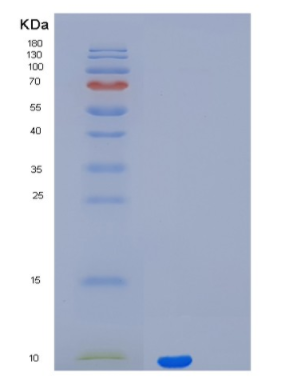 Recombinant Parathyroid Hormone Protein,Recombinant Parathyroid Hormone Protein