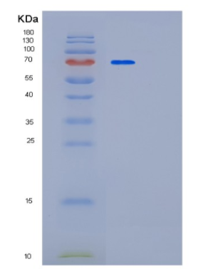 Recombinant Human PAPSS1 Protein,Recombinant Human PAPSS1 Protein