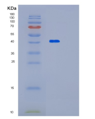 Recombinant Human PALM Protein,Recombinant Human PALM Protein