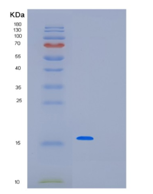 Recombinant Human PAIP2 Protein,Recombinant Human PAIP2 Protein