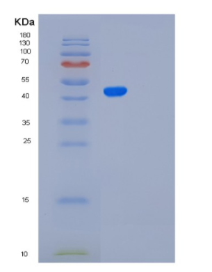 Recombinant Human PAFAH2 Protein,Recombinant Human PAFAH2 Protein