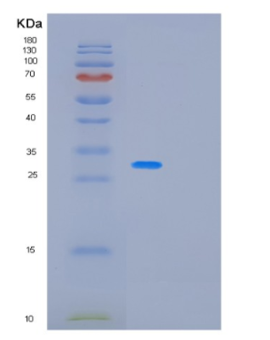 Recombinant Human PAFAH1B3 Protein,Recombinant Human PAFAH1B3 Protein