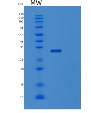 Recombinant Human OSCAR Protein,Recombinant Human OSCAR Protein