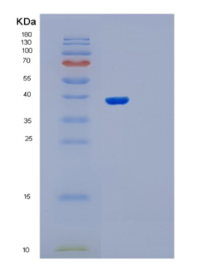 Recombinant Human OSGEP Protein,Recombinant Human OSGEP Protein