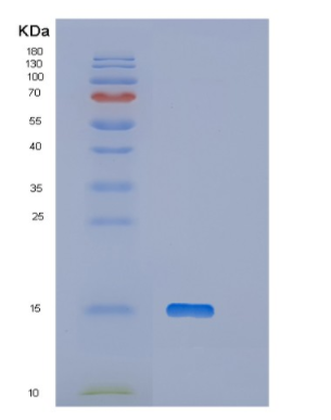 Recombinant Human OTOR Protein,Recombinant Human OTOR Protein