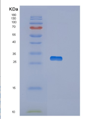 Recombinant Human OTUB2 Protein,Recombinant Human OTUB2 Protein