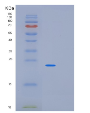 Recombinant Human PABPN1 Protein,Recombinant Human PABPN1 Protein